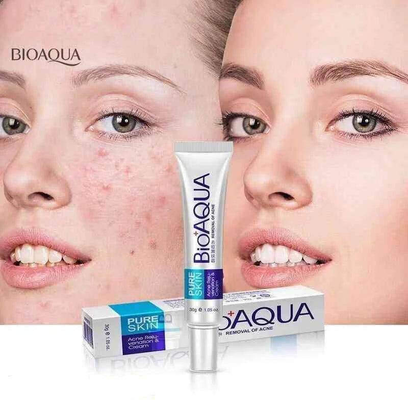 Bioaqua Acne Scar Removal Rejuvenation cream 30g