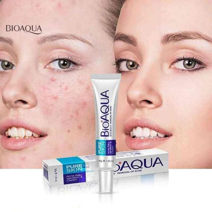 Bioaqua Acne Scar Removal Rejuvenation cream 30g